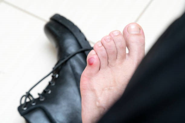 Diabetes foot care tips for healthy and pain-free feet