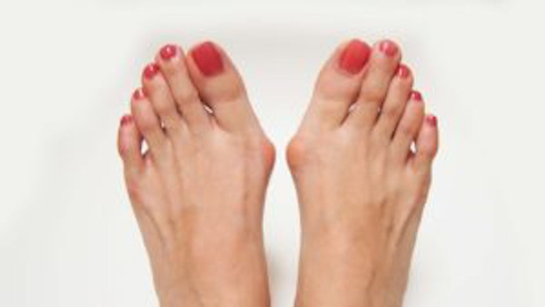 Wide-fit shoes for hallux valgus relief
