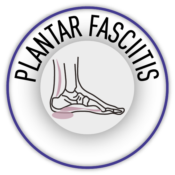 Illustration showing the plantar fascia, the tissue affected by Plantar Fasciitis